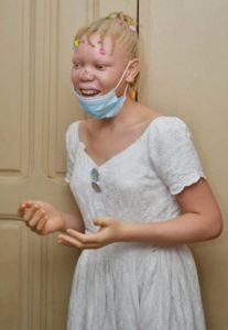 Albinos